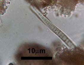 blue green alga filament in tufa